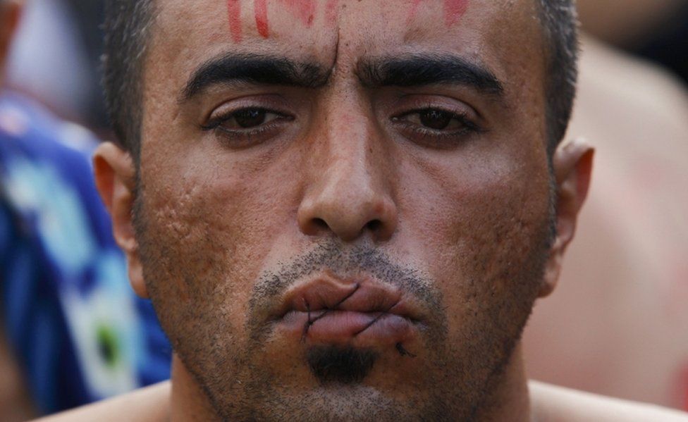 Migrant with lips sewn together