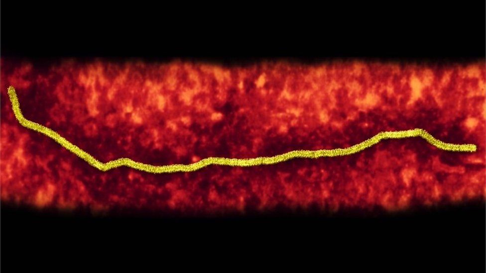 Nipah virus particle. Transmission electron micrograph (TEM) of Nipah virus (NiV) particle (virion)