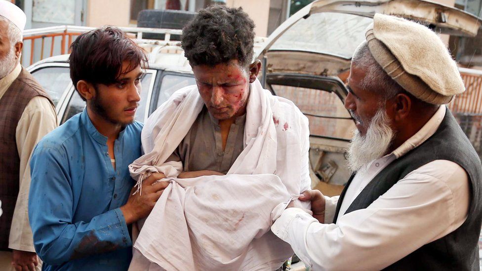 A boy who was injured in an explosion that targeted the Friday congregation prayers at a Mosque in Haska Mina district of Nangarhar province, receives medical treatment at a hospital