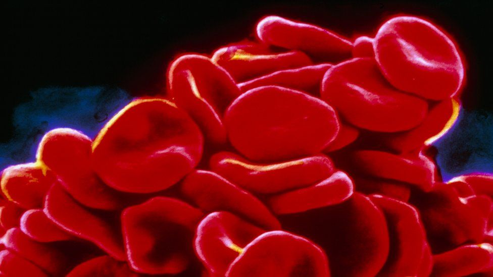 Ген заболевание крови. ДВС синдром эритроциты. Red Human Cell Blood.