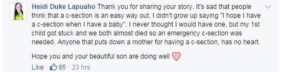 Thank you for sharing your story. It's sad that people think that a c-section is an easy way out. I didn't grow up saying "I hope I have a c-section when I have a baby". I never thought I would have one, but my 1st child got stuck and we both almost died so an emergency c-section was needed. Anyone that puts down a mother for having a c-section, has no heart.