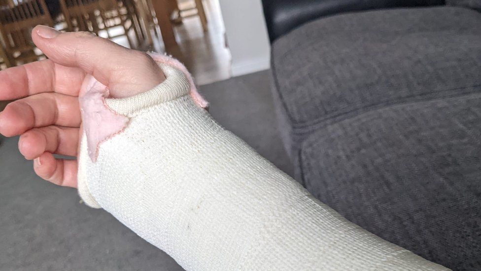 Louise Ketteringhams Hand im Gips