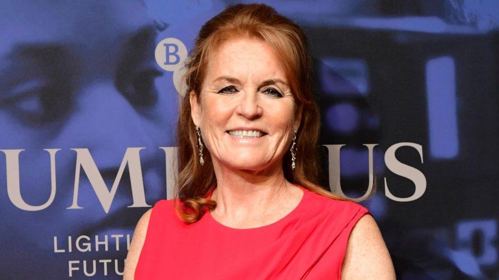 Sarah Ferguson names left breast "Derek"