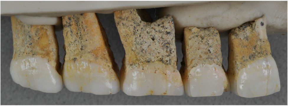 Homo luzonensis teeth