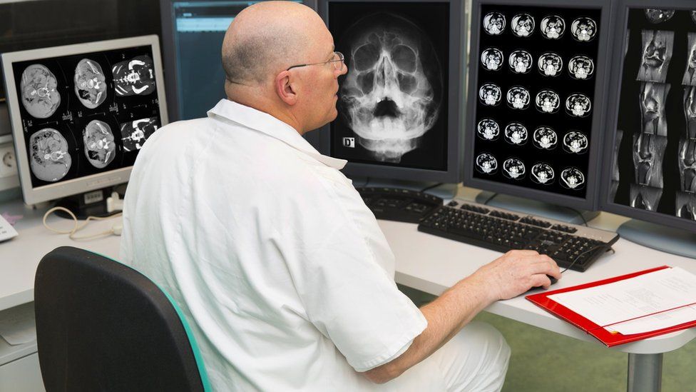 A radiologist examining an MRI scan