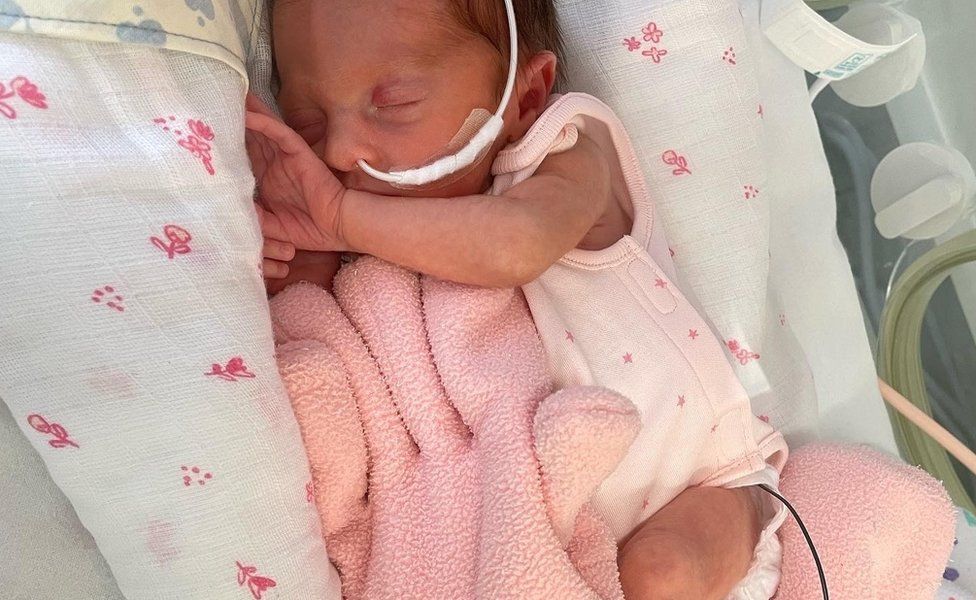 Baby at Rotherham General Hospital