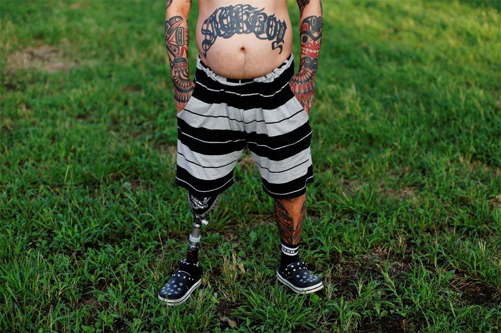 A man stands on grass wearing shorts, showing a prosthetic leg and a tattooed leg