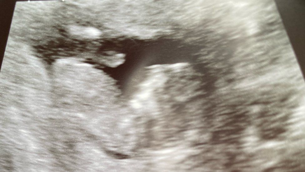 Scan of Beth's third baby