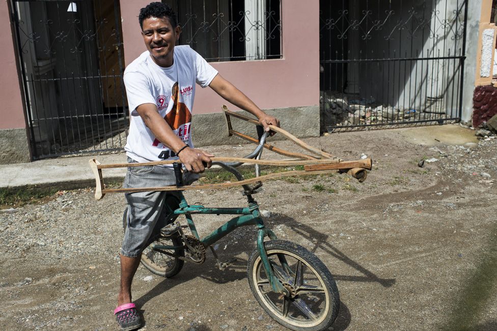 Óscar lost a leg in an accident at work, he says he is not getting any support in Honduras