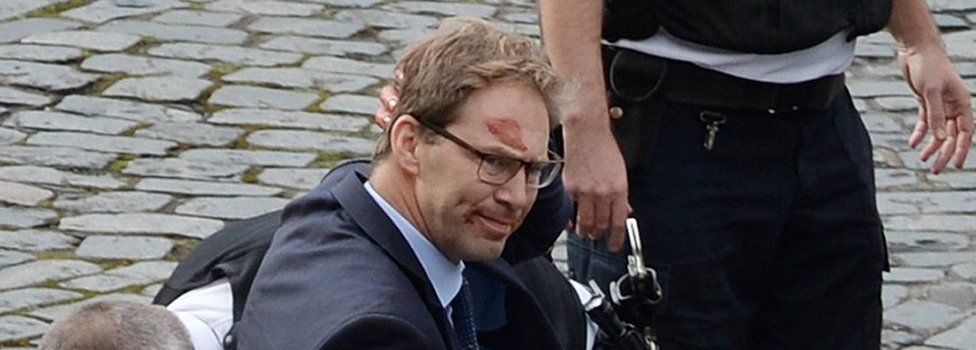 Tobias Ellwood with blood on his face after the attack