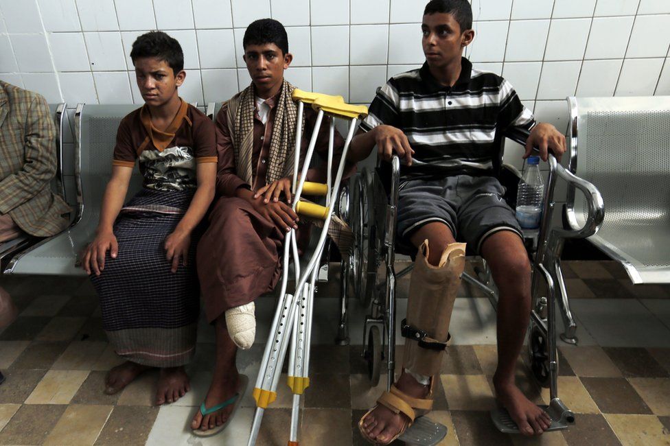 Disabled young Yemenis wait for treatment at a rehabilitation centre in Sanaa (4 June 2016)