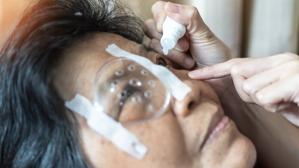 Woman getting eye drops