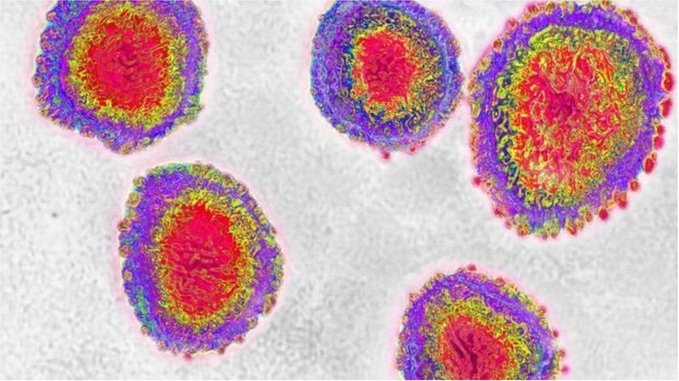 করোনাভাইরাস