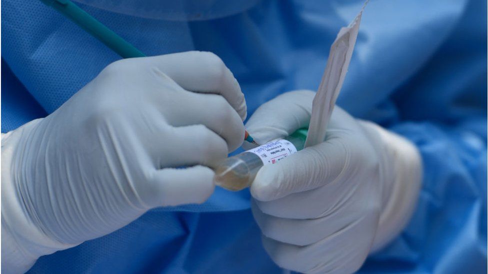 A doctor holds a Covid-19 test sample.