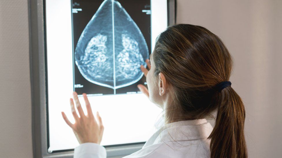 Radiographer looking at mammogram