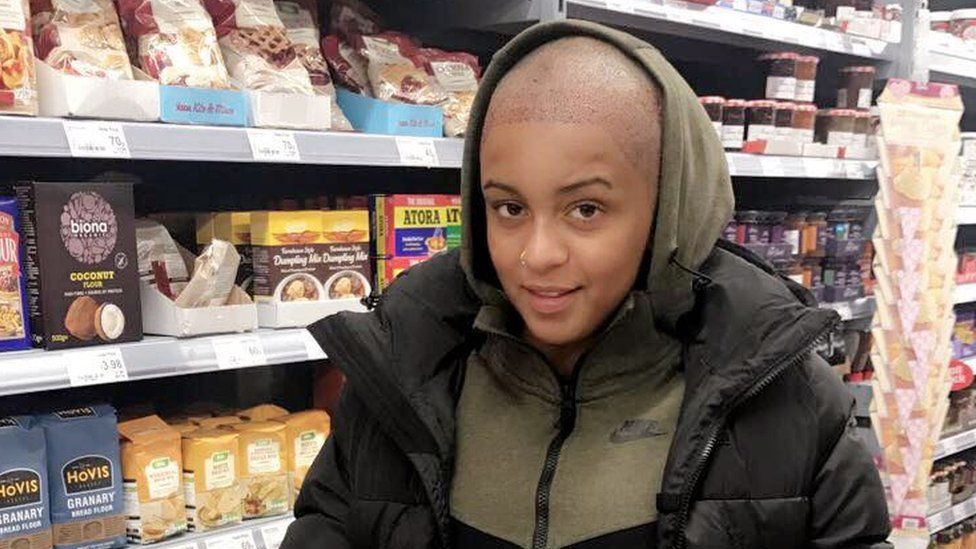 Paigey Cakey immediately after her transplant