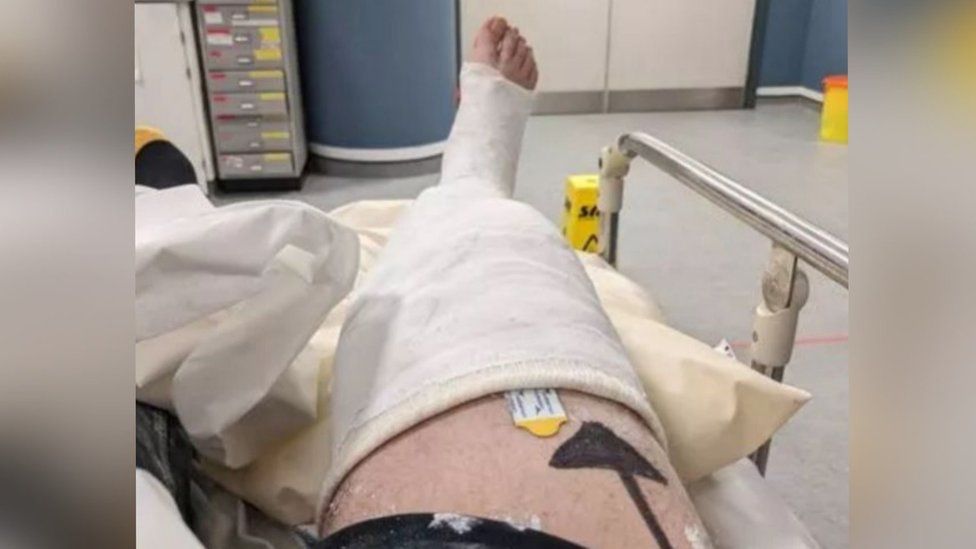 The victim spent Christmas in hospital with a broken leg in 2021