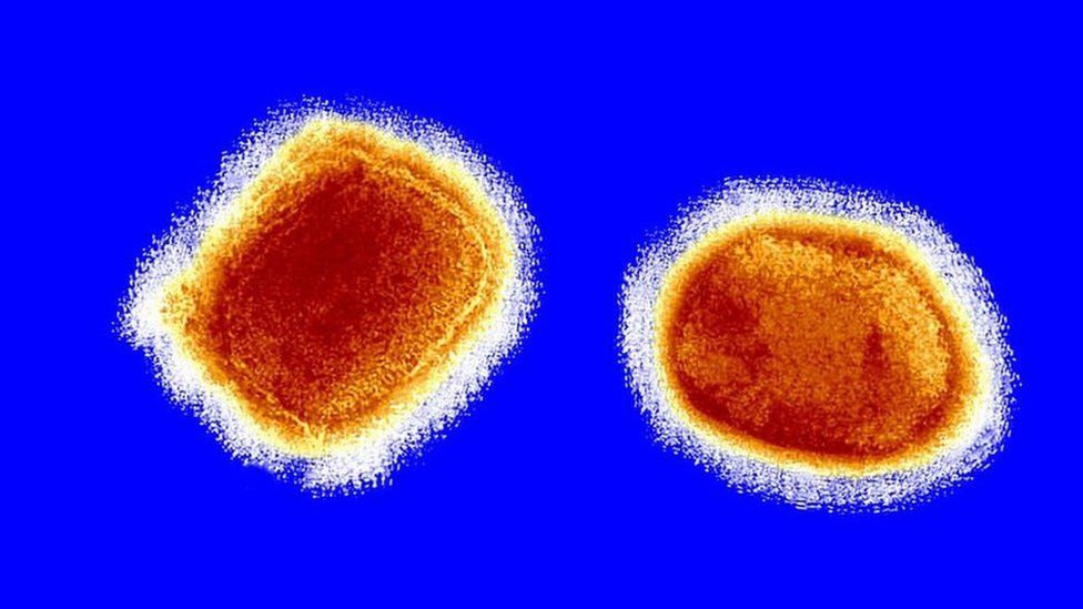 Monkeypox virus seen under an electron microscope