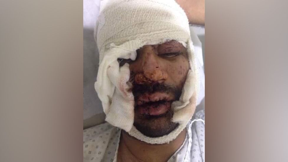 Mohammad Farim, injured in hospital