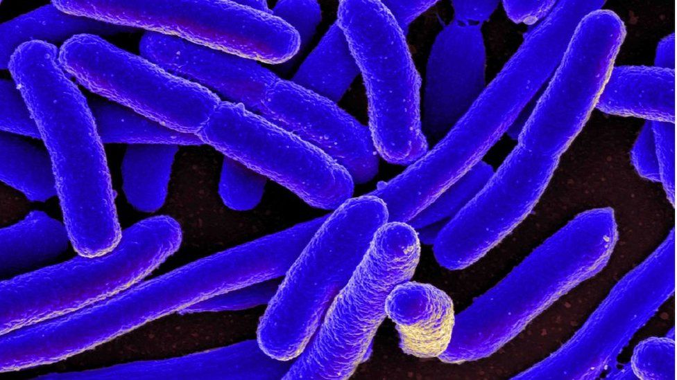 Colorized scanning electron micrograph of Escherichia coli