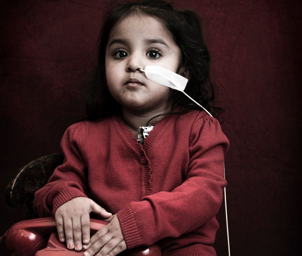A young girl with a tube attached to her nose holds a phone