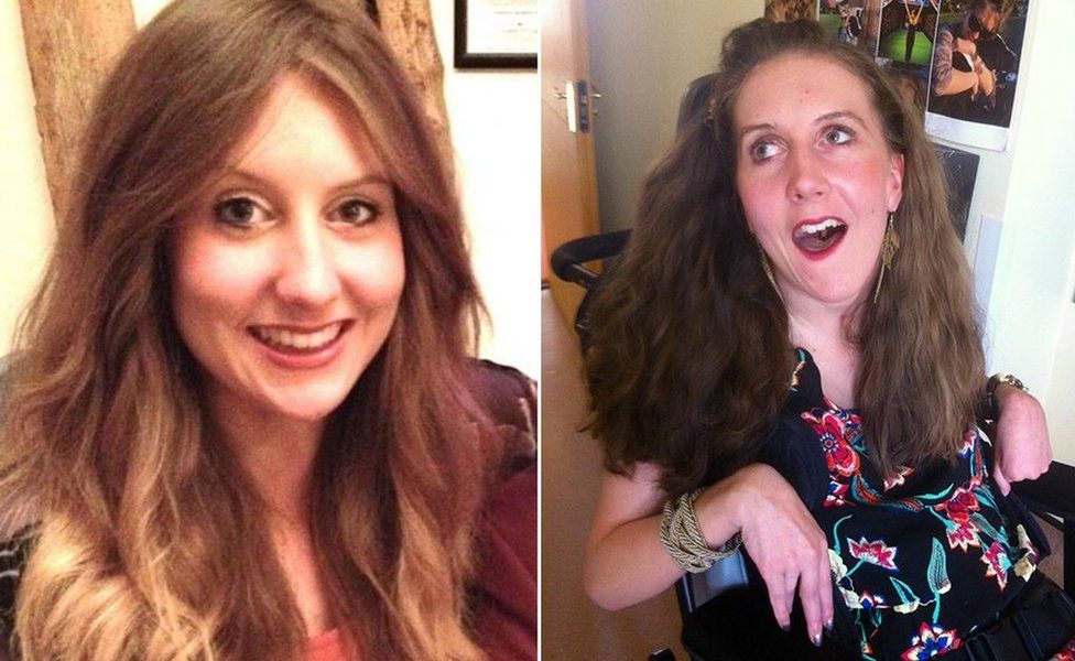 Amy May Shead before and after her anaphylactic shock