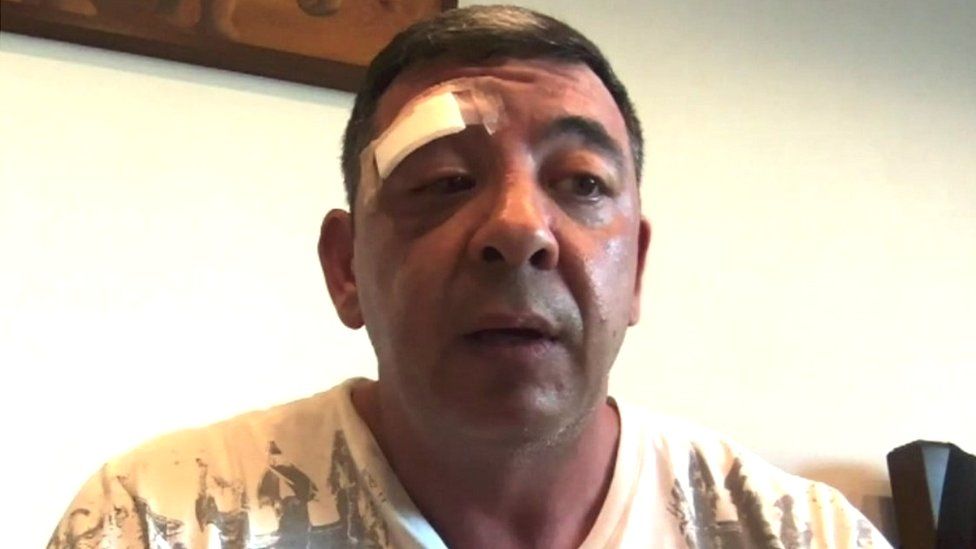 Thailand gym attack Hastings victim's face 'butchered' BBC News