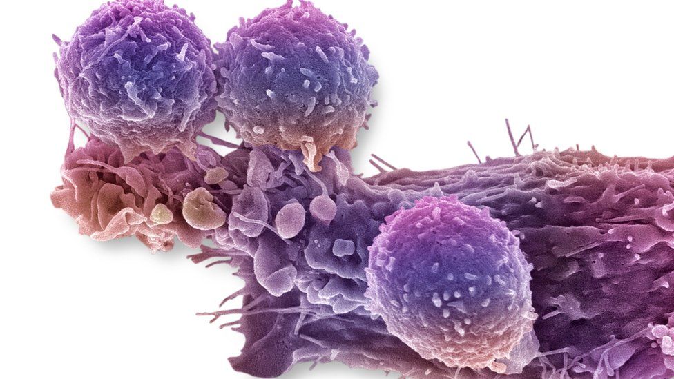 Immune cells attacking cancerous tissue