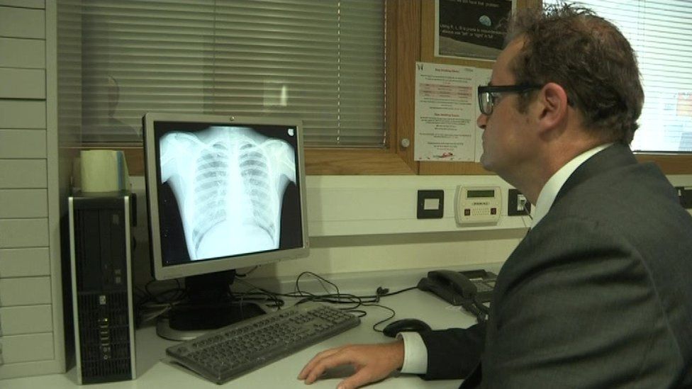 Prof Edward McKone looks at a scan of a cystic fibrosis patient