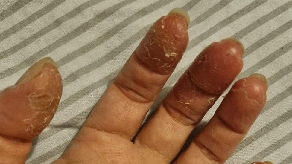 Close up of peeling fingers