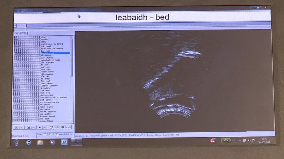 Dealbh ultrasound