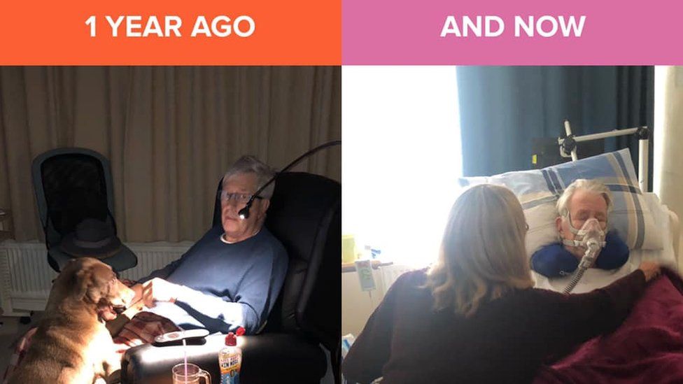 Mr Gibson sitting in his chair, and then a year later with a mask on in bed, very poorly