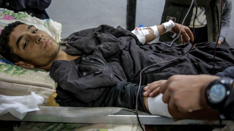 A man receives treatment at Al-Shifa hospital in Gaza City, after he was injured in an early morning incident when residents rushed toward aid trucks in Gaza City