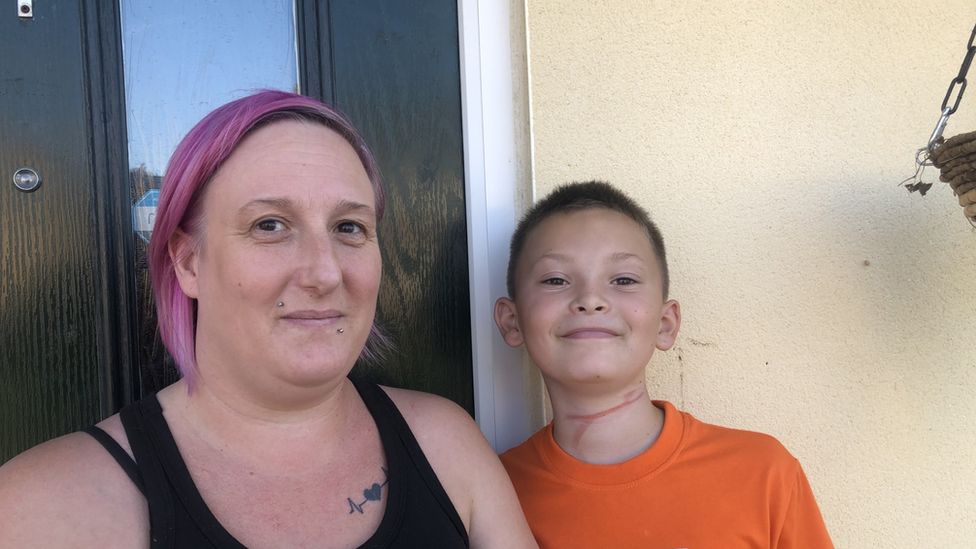 March mother's warning after son injured by dog lead BBC News