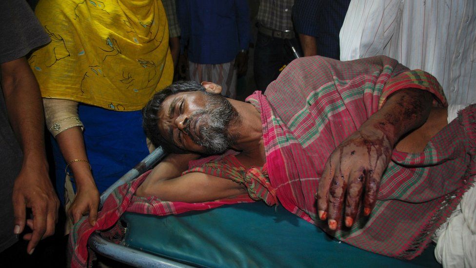 An injured Bangladeshi man is carried on a stretcher at Chittagong hospital in Chittagong on April 4, 2016, after a protest at Banshkhali turned violent