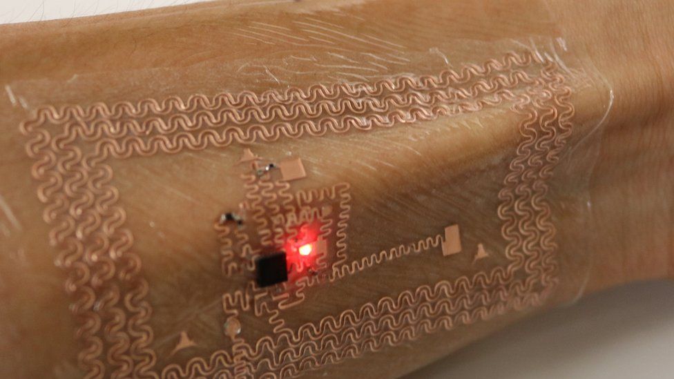 A tattoo-like system can measure blood flow in the fingertips