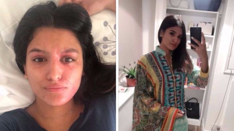 Images of Resham Khan after the attack, before and after applying makeup