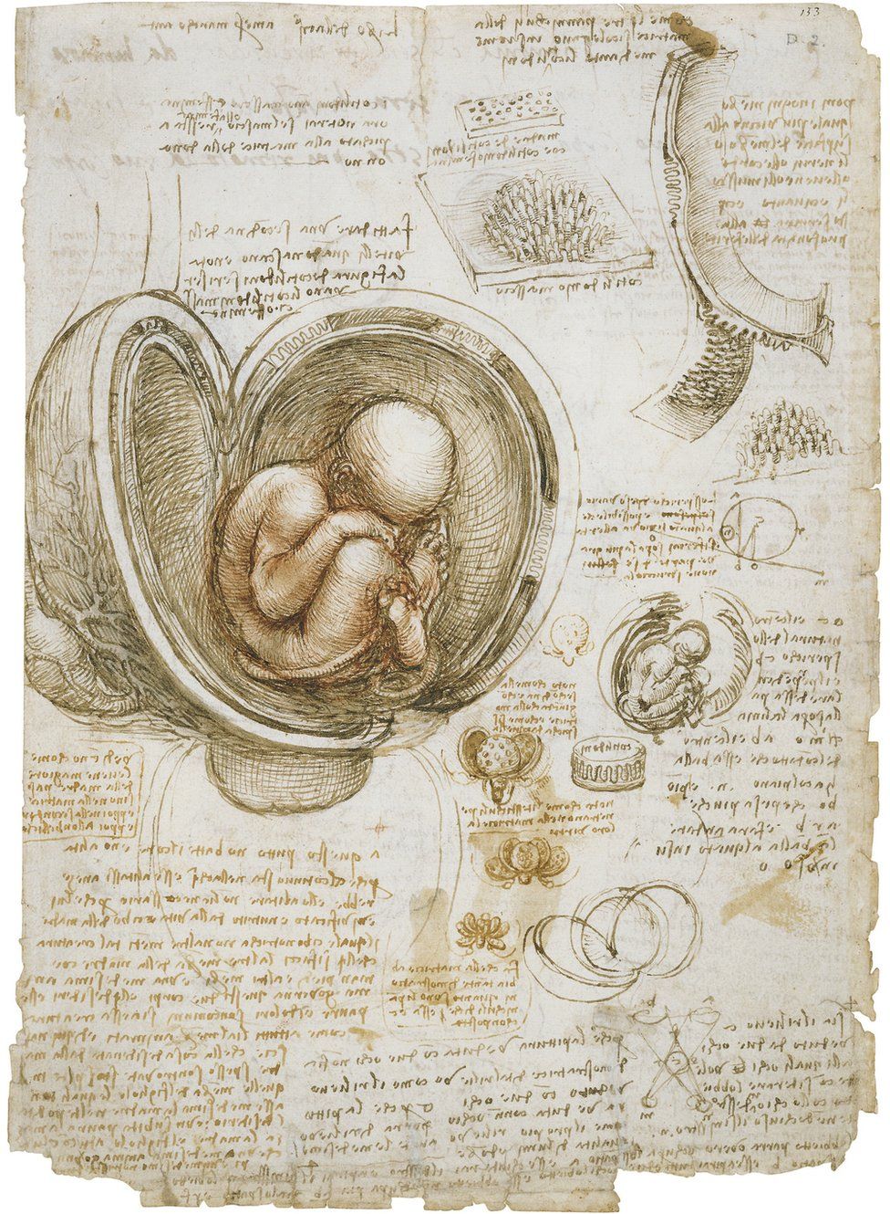 Anatomical drawing showing a foetus in a womb by Leonardo da Vinci
