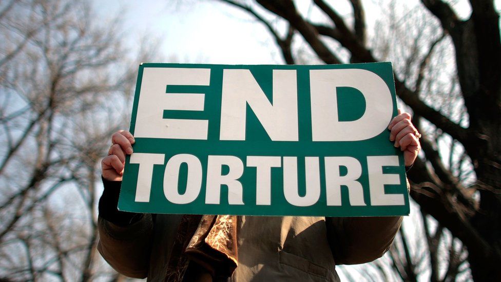 A man holds a sign which says 'end torture'