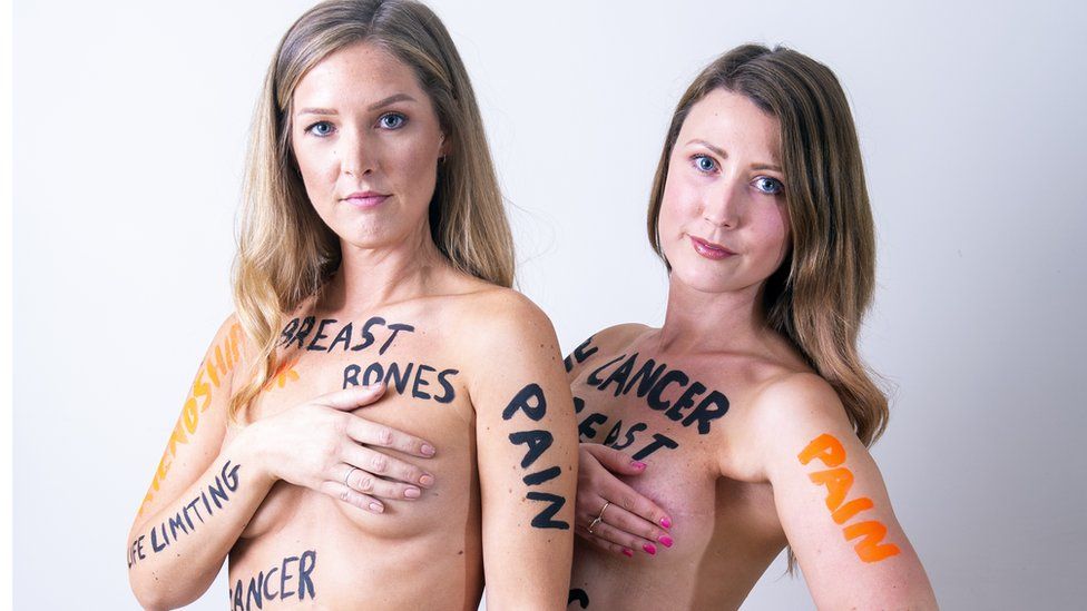 Nicky (left) and Laura (right) naked and with writing over their bodies about their cancer fight