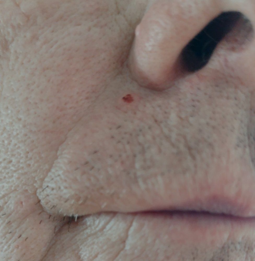 Close-up of Andrew Battye's face