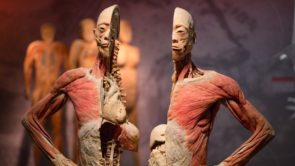 The preserved human body of a man on exhibit in Sydney