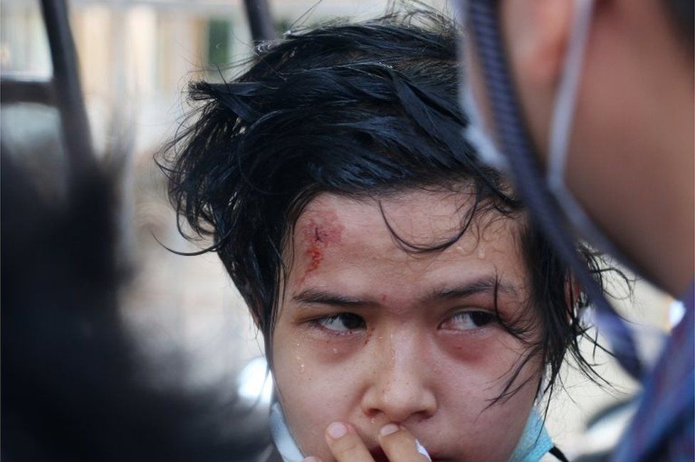 A demonstrator injured by police water cannon looks on during a protest against the military coup, in Nay Pyi Taw, Myanmar, 09 February 2021.