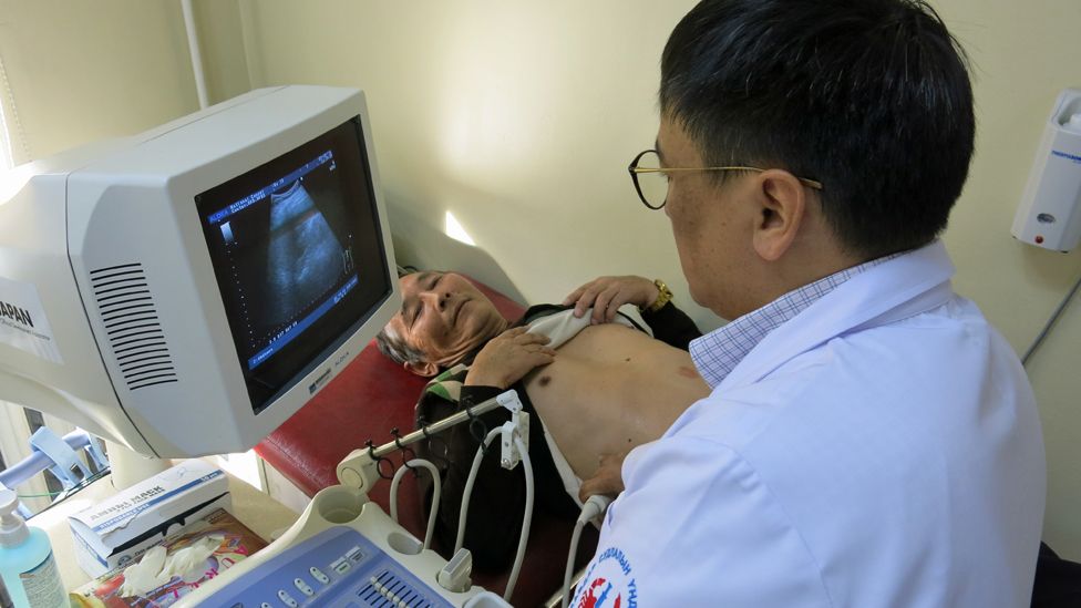 A doctor at the national cancer hospital examines a small liver tumour using ultrasound