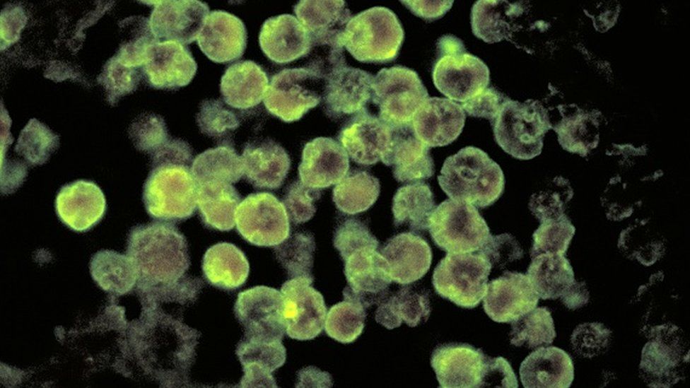 A microscopic image of Naegleria fowleri