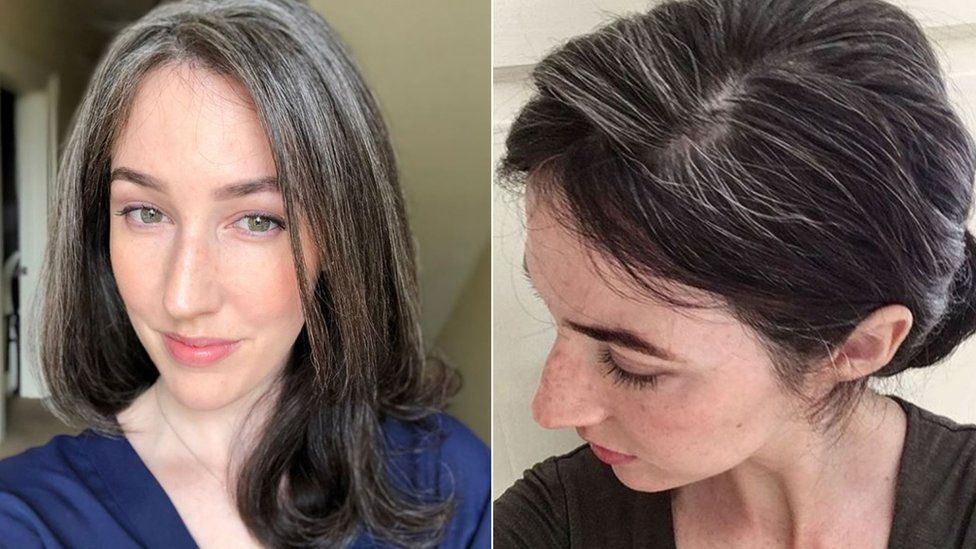 Side-by-side photographs of Martha showing off hair progress