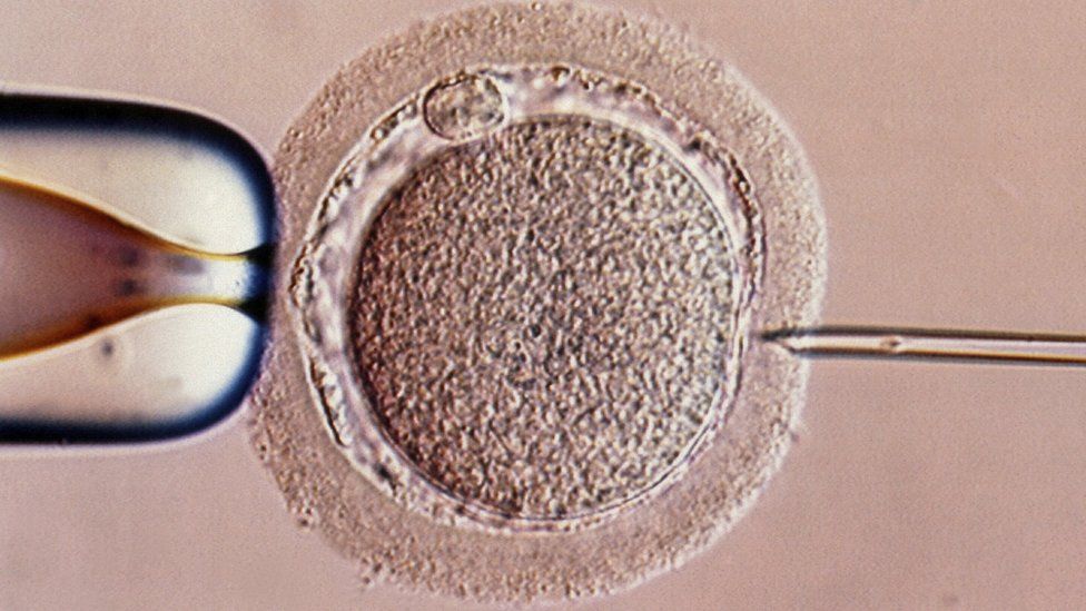 File image of IVF