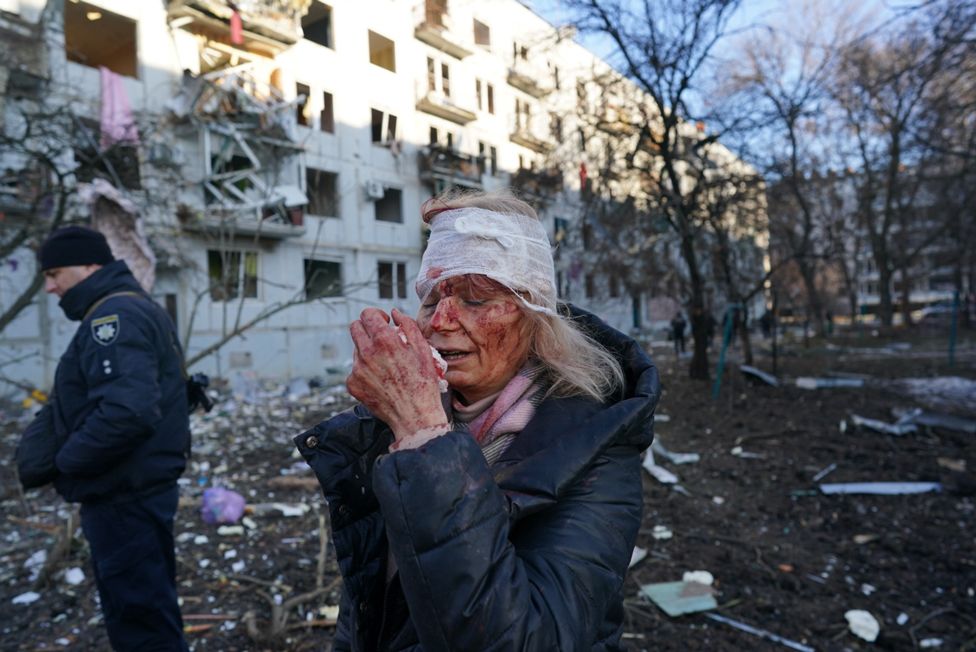 A wounded woman is seen after an airstrike damaged an apartment complex in city of Chuhuiv, Kharkiv Oblast, Ukraine on 24 February 2022