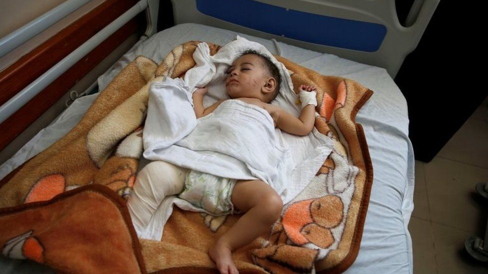 Палестинский младенец Омар Аль-Хадиди лежит на больничной койке после того, как представители здравоохранения Газы заявили, что израильская ракета попала в дом, убив его мать и четырех братьев и сестер, в городе Газа 15 мая 2021 г.