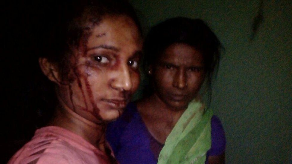 Рупали Мешрам и ее мать вскоре после нападения